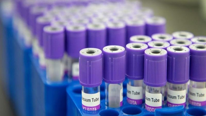 NHS: Kanseri tespit edebilen kan testini denemeye hazırız