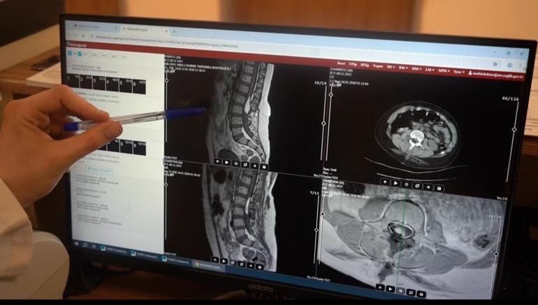 Belindeki tümör nedeniyle felç riski bulunan Bünyamin, sağlığına kavuştu