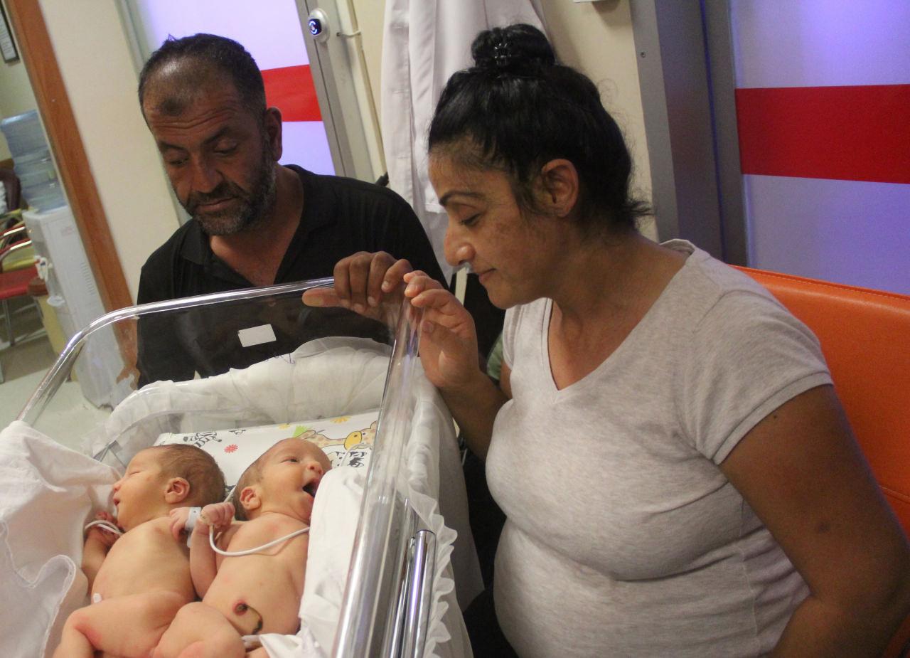 Hikayelerine yürek dayanmaz: Hatay'da yetim ve öksüz siyam ikizlerini ölüm ayırdı